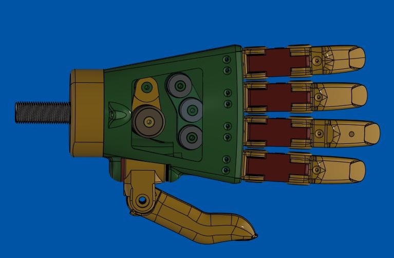 partial-hand-solutions-hand-prosthetic-model